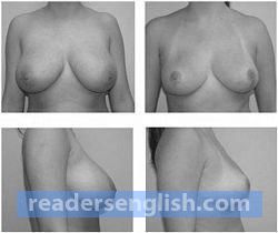 breast Urdu meaning