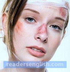 bruise Urdu meaning