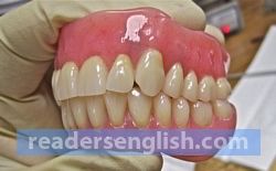 denture Urdu meaning