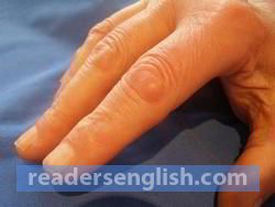 knuckle Urdu meaning