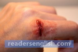 wound Urdu meaning